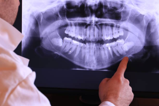 Best Broken or Cracked Tooth Emergency Dentist in Maitland, FL