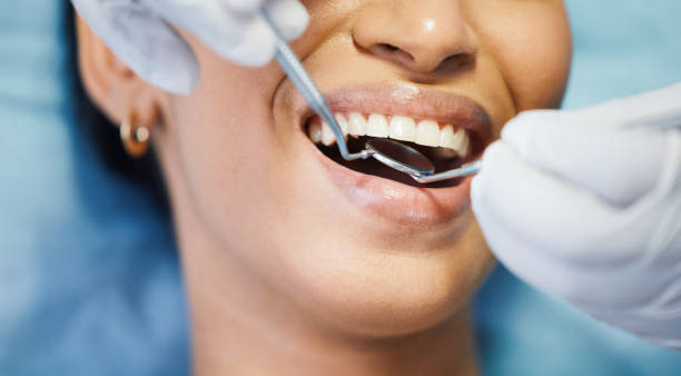 Best Emergency Dentist for Knocked-Out Tooth in Maitland, FL